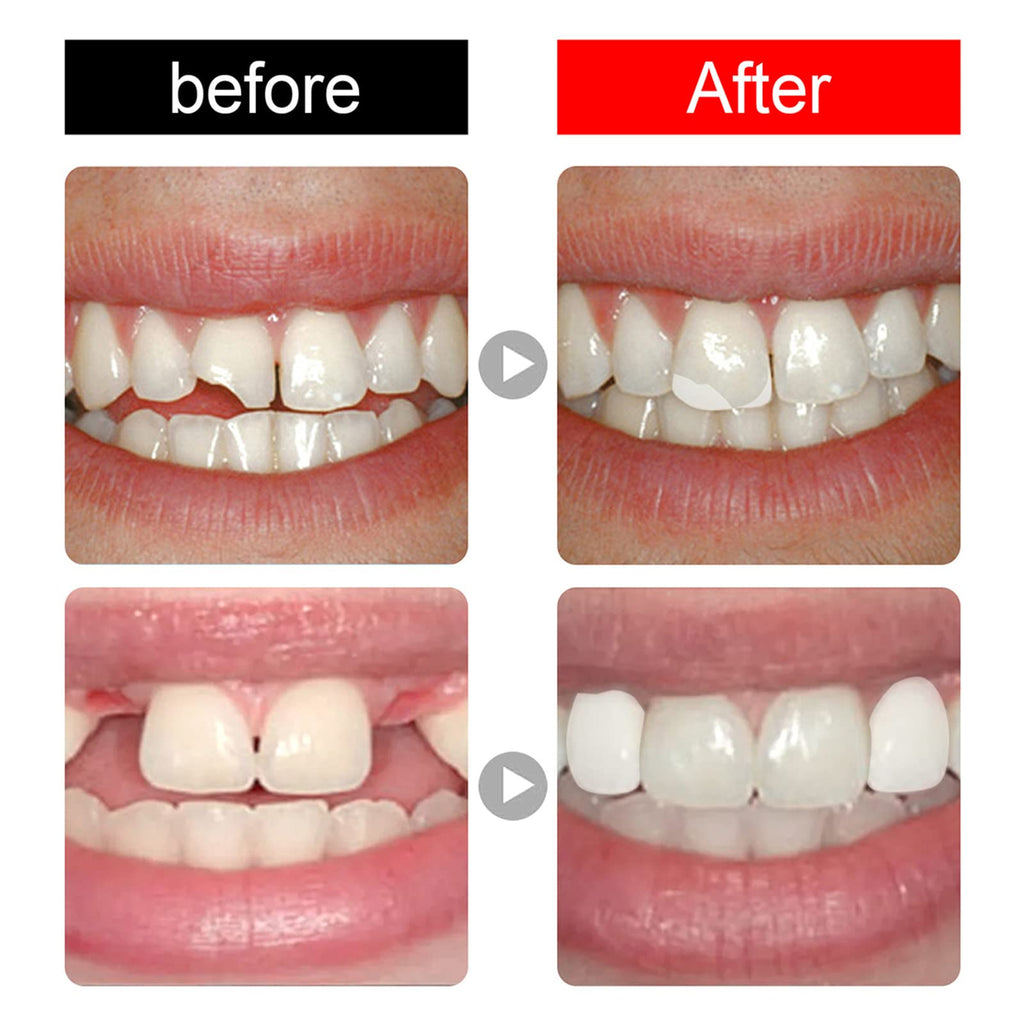 168 Pieces Acrylic Resin Denture Teeth 6 Sets 23 Shade A2 Upper + Lower Z419069
